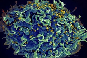 'حمض الريتينويك' هو المنقد من فيروس نقص المناعة البشرية