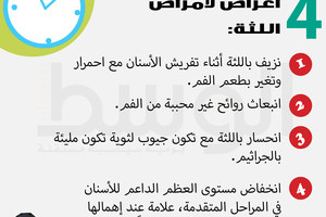 دقيقة من أجلك... 4  أعراض لأمراض اللثة