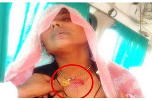 «قلادة» تُنجي شابة هندية حاول شقيقها قتلها