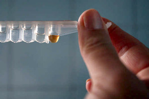 نتائج واعدة للقاح ضد الايدز سيجرب على نطاق أوسع