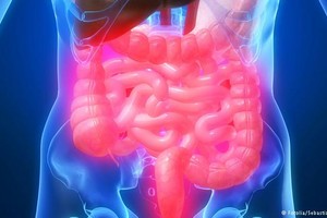 اختلال التوازن في بكتيريا الأمعاء يؤدي إلى الإصابة بالسكري
