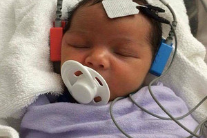 بالفيديو... طفل أصمّ يسمع صوت والدته للمرة الأولى