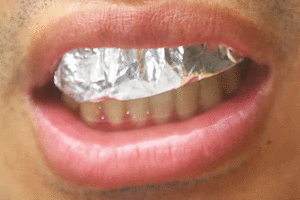 بالفيديو ... ماذا يحدث عند تغطية أسنانك بورق الألمنيوم لمدة ساعة؟