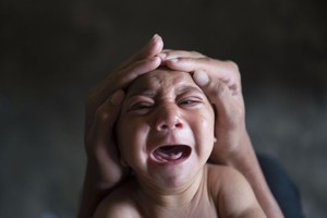 'عشرات الآلاف' من المواليد قد يتأثرون بفيروس زيكا