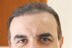 ﻿تأثير ضربات الشمس والحرارة والرطوبة الشديدة