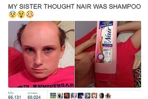 بالصور... استخدمت مزيل الشعر بدل الشامبو فهذا ما حدث لها