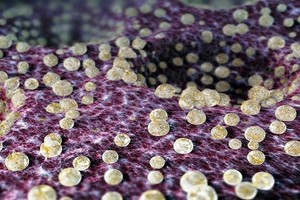 علماء روسيا يتوصلون لعلاج مرض الكلاميديا