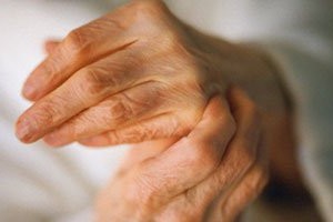 دراسة: علاج لالتهاب المفاصل الروماتويدي بالخلايا الجذعية يظهر نتائج واعدة