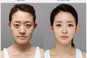 تعرف على 'الكونتور'... 'مُغني' عاشقات الجمال عن عيادات التجميل!  