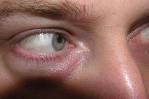 الهند.. النظر أكثر من 14 ثانية إلى امرأة جريمة!