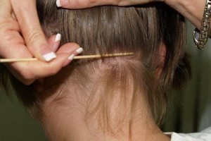 دبي.. القملة بـ14 درهماً !