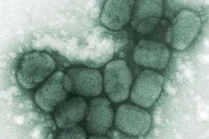 وفاة دونالد هندرسون الذي قاد جهود القضاء على الجدري عن 87 عاما