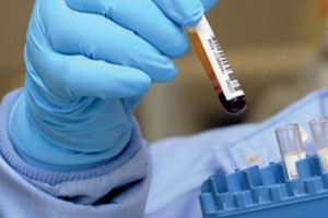 محطة: اختبارات أول حالة يُشتبه بإصابتها بزيكا في هونج كونج جاءت سلبية