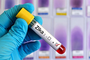 40 إصابة محلية بفيروس زيكا في سنغافورة