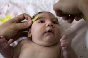 منظمة الصحة تحذر من خطر انتشار زيكا في أميركا ومناطق أخرى