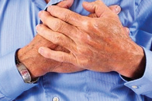 باحثون يربطون الإصابة بالإكزيما وحمى القش بالاستخدام المبكر للمضادات الحيوية