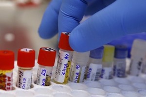 المكسيك تؤكد ظهور حالات إصابة بمتلازمة جيلان-باريه مرتبطة بزيكا