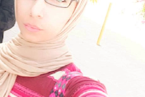 قصة قصيرة... النّدْبة