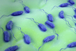 منظمة الصحة العالمية تحذر من زيادة انتشار مرض الكوليرا في اليمن