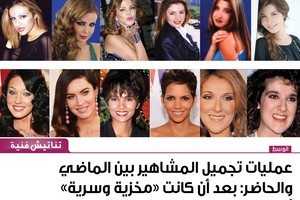 عمليات تجميل المشاهير بين الماضي والحاضر: بعد أن كانت 'مخزية وسرية' أصبحت 'معلنة وضرورية'، ما الذي تغير؟!