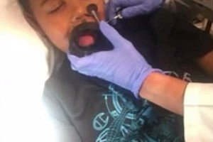 بالصور: طفل علّق لسانه بقارورة مياه.. فماذا حصل له؟!