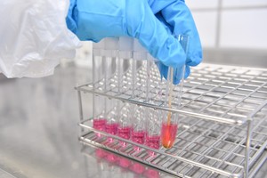 تأكيد تفشي فيروس إنفلونزا الطيور في ست دول أوروبية