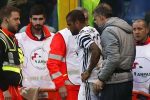 ألفيش وبونوتشي ينضمان إلى قائمة الإصابات في يوفنتوس