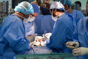 عد جراحة استغرقت 17 ساعة... فصل توأمين ملتصقين في كاليفورنيا