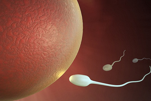 مستشفى في هولندا ربما أعطى للنساء حيوانات منوية خاطئة