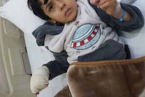 ذئب ينهش يد طفل في مجمع تجاري بالسعودية