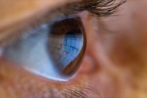 دراسة: سرعة التشخيص قد تحسن حياة مرضى التهاب القرنية وجفاف الملتحمة