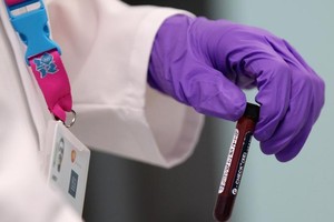 فيلم وثائقي يكشف المزيد من الحقائق في قضية المنشطات الروسية