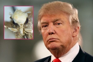 إطلاق اسم 'دونالد ترامب' على حشرة صغيرة تميل للصفرة