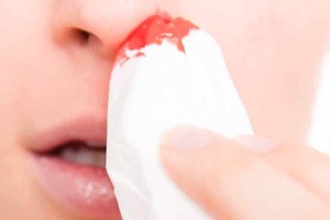 سعودية أصيب ابنها بـ 'نزف الرعاف' فاخترعت آلة طبية لوقفه