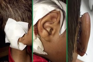 معلم يقطع جزءاً من أذن طالب بقلم رصاص في السعودية