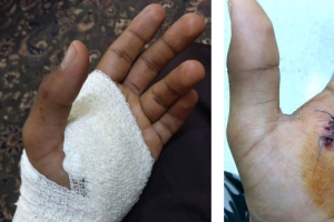 ﻿طالب يعتدي على زميله بـ «دريل»... و«التربية»: إحالة الواقعة للجهة القانونية بالوزارة