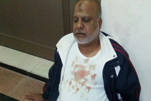 'الجعفرية'لـ'الوسط' : تعرّض قيّم جامع الزهراء في مدينة حمد إلى اعتداء من ملثمين