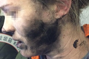 سماعات الرأس لراكبة تنفجر على متن طائرة