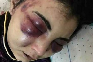 أذاق زوجته أصناف العذاب لإنشائها صفحة على 'فيسبوك'