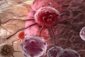 اختراع روسي جديد لعلاج السرطان