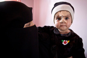 زيادة الأمن وإمكانية الوصول للمحتاجين لا غنى عنهما لتجنب حدوث مجاعة في اليمن