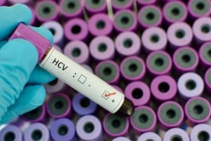 خطة دولية للقضاء على التهاب الكبد