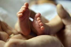 حياة جديدة لطفلة من بنغلاديش مولودة بثلاث أرجل