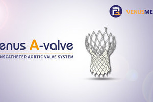 ‫موافقة 'الغذاء' الصينية على جهاز شركة فينوس ميدتيك للقسطرة يطلق مرحلة جديدة من التدخل العلاجي للقلب