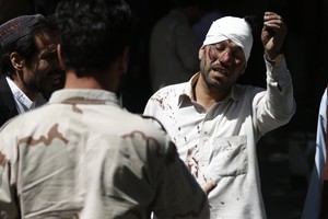 بالصور... انفجار شاحنة مفخخة يوقع 90 قتيلاً ومئات الجرحى في كابول